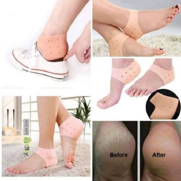 Heel Anti-Crack Sets | ফাটা গোড়ালির নির্ভরযোগ্য সমাধান - Image 3